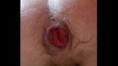 Ass fisting part 1 Thumb